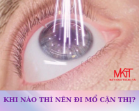 KHI NÀO THÌ NÊN ĐI MỔ CẬN THỊ?